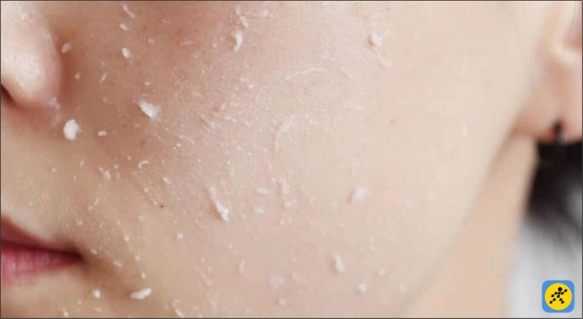 Nên tiến hành tẩy tế bào chết 1-2 lần/tuần để tránh tình trạng mốc nền khi makeup